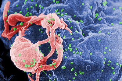 美專家小組籲HIV篩檢例行化